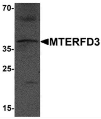Western Blot: MTERFD3 AntibodyBSA Free [NBP2-81741]