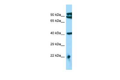 Western Blot: MTERFD3 Antibody [NBP2-83238]