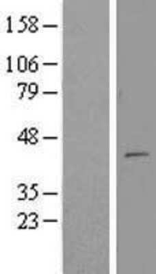 Western Blot: MTERFD3 Overexpression Lysate [NBL1-13359]