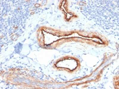 Immunohistochemistry-Paraffin: MTF1 Antibody (MTF1/2649) [NBP3-07236]