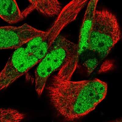 Immunocytochemistry/ Immunofluorescence: MTF2 Antibody [NBP2-55885]