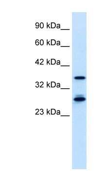 Western Blot: MTF2 Antibody [NBP1-80038]