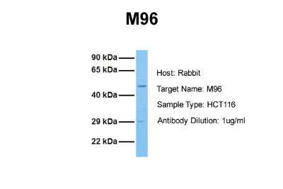 Western Blot: MTF2 Antibody [NBP1-80038]