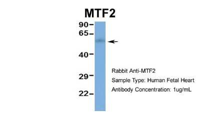 Western Blot: MTF2 Antibody [NBP1-97438]