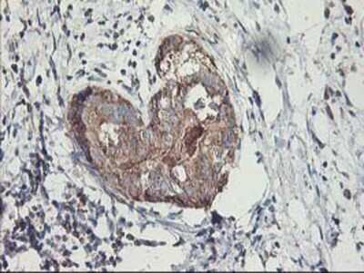 Immunohistochemistry-Paraffin: MTFMT Antibody (OTI1E7) [NBP2-01232]