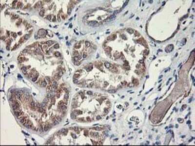 Immunohistochemistry-Paraffin: MTFMT Antibody (OTI1E7) [NBP2-01232]