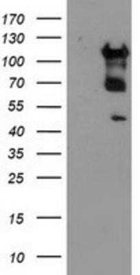 Western Blot: MTFMT Antibody (OTI1E7)Azide and BSA Free [NBP2-72801]