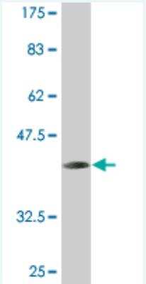 Western Blot: MTGR1 Antibody (2H8) [H00009139-M06]