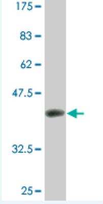 Western Blot: MTGR1 Antibody (3G8) [H00009139-M07]