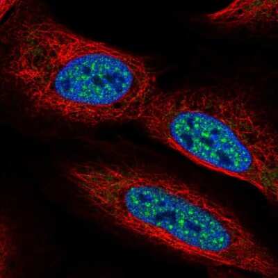 Immunocytochemistry/ Immunofluorescence: MTGR1 Antibody [NBP2-56057]