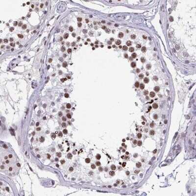 Immunohistochemistry-Paraffin: MTGR1 Antibody [NBP2-34136]