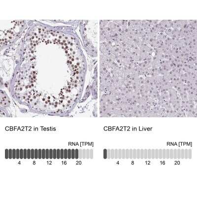 Immunohistochemistry-Paraffin: MTGR1 Antibody [NBP2-34136]