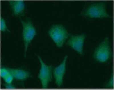 Immunocytochemistry/ Immunofluorescence: MTH1 Antibody (AT3B3) - BSA Free [NBP2-61160]