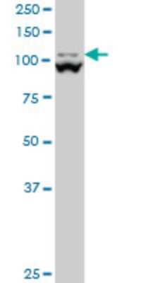 Western Blot: MTHFD1L Antibody (1E8) [H00025902-M01]