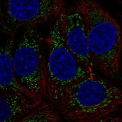 Immunocytochemistry/ Immunofluorescence: MTHFD1L Antibody [NBP2-57852]