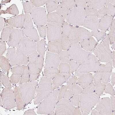Immunohistochemistry-Paraffin: MTHFD1L Antibody [NBP2-37864]