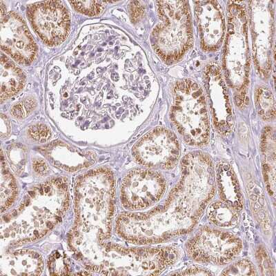 Immunohistochemistry-Paraffin: MTHFD1L Antibody [NBP2-37864]