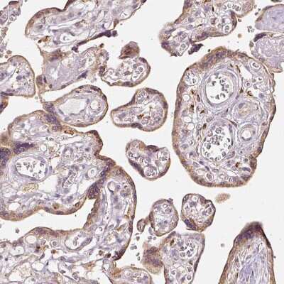 Immunohistochemistry-Paraffin: MTHFD1L Antibody [NBP2-37864]