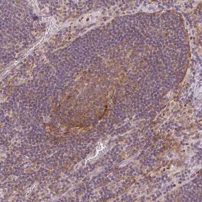 Immunohistochemistry-Paraffin: MTHFD1L Antibody [NBP2-37864]