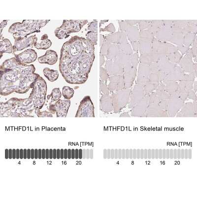 Immunohistochemistry-Paraffin: MTHFD1L Antibody [NBP2-37864]