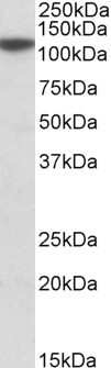 Western Blot: MTHFD1L Antibody [NBP1-78279]