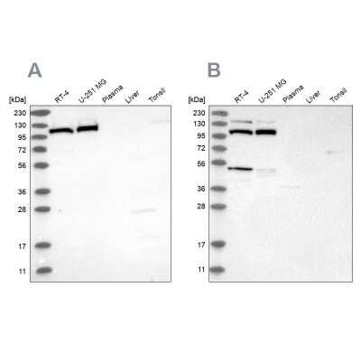 Western Blot: MTHFD1L Antibody [NBP2-37864]