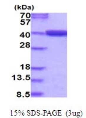 SDS-PAGE: Recombinant Human MTHFD2 His Protein [NBP2-51979]