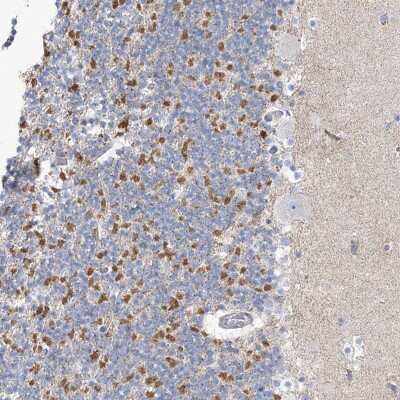 Immunohistochemistry-Paraffin: MTHFD2L Antibody [NBP1-82663]