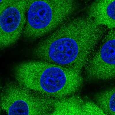 Immunocytochemistry/ Immunofluorescence: MTHFS Antibody [NBP2-58656]