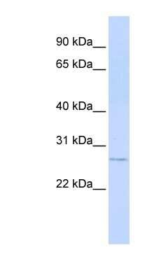 Western Blot: MTHFS Antibody [NBP1-56698]