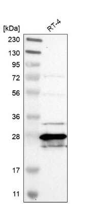 Western Blot: MTHFS Antibody [NBP1-83161]