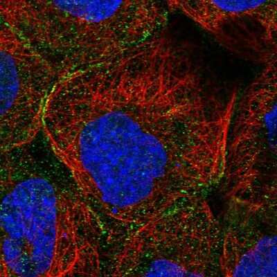Immunocytochemistry/ Immunofluorescence: MTHFSD Antibody [NBP1-82271]