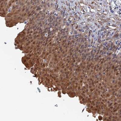 Immunohistochemistry-Paraffin: MTHFSD Antibody [NBP1-82271]