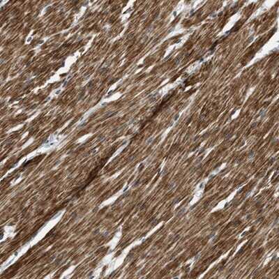 Immunohistochemistry-Paraffin: MTMR1 Antibody [NBP1-86042]