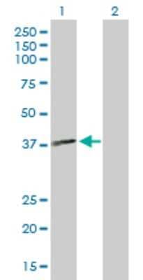 Western Blot: MTMR1 Antibody [H00008776-B01P]