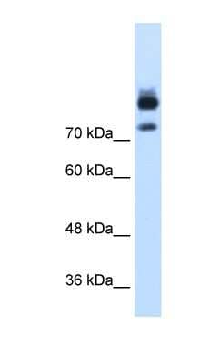 Western Blot: MTMR1 Antibody [NBP1-55486]