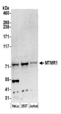 Western Blot: MTMR1 Antibody [NBP2-44289]
