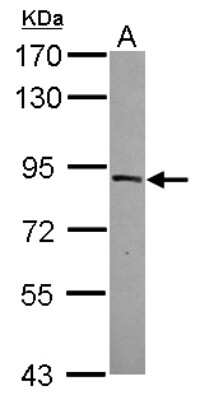 Western Blot: MTMR12 Antibody [NBP2-19432]