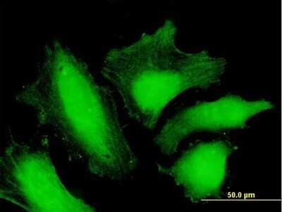 Immunocytochemistry/ Immunofluorescence: MTMR15 Antibody [H00022909-B01P]