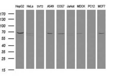 Western Blot: MTMR2 Antibody (OTI1F10) [NBP2-46035]