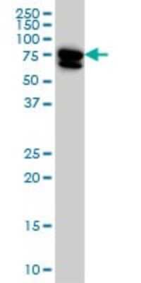 Western Blot: MTMR2 Antibody (4G6) [H00008898-M03]