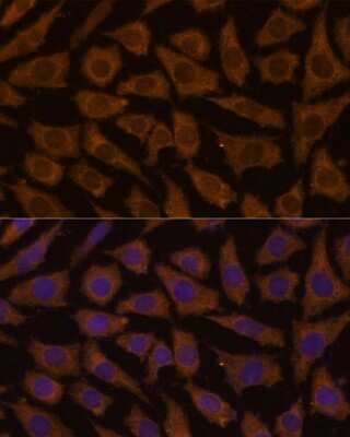 Immunocytochemistry/ Immunofluorescence: MTMR4 Antibody - Azide and BSA Free [NBP2-94706]
