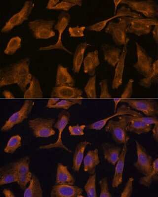 Immunocytochemistry/ Immunofluorescence: MTMR4 Antibody - Azide and BSA Free [NBP2-94706]