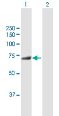 Western Blot: MTMR6 Antibody [H00009107-B01P]