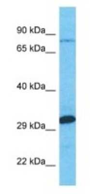 Western Blot: MTMR7 Antibody [NBP3-09576]