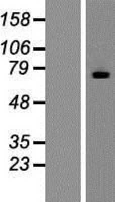 Western Blot: MTMR7 Overexpression Lysate [NBP2-07841]