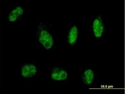 Immunocytochemistry/ Immunofluorescence: MTMR8 Antibody [H00055613-B01P]