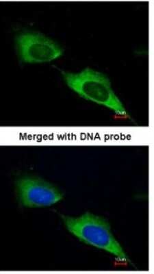 Immunocytochemistry/ Immunofluorescence: MTMR9 Antibody [NBP1-31078]
