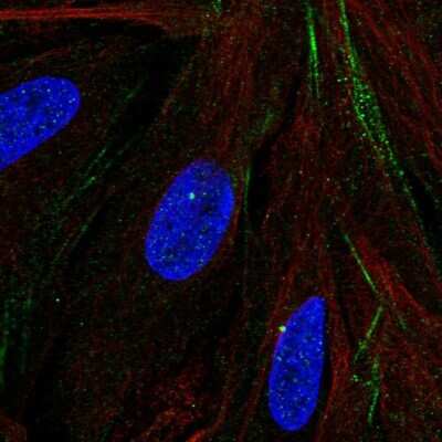 Immunocytochemistry/ Immunofluorescence: MTMR9 Antibody [NBP2-57980]