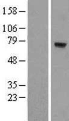 Western Blot: MTO1 Overexpression Lysate [NBL1-13381]